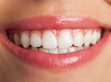 Top Reasons Your Smile Dims and How to Brighten It Fast